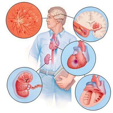 Cardiol предотвратява развитието на съпътстващи заболявания